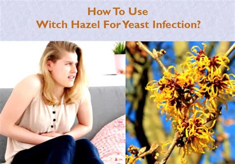 can witch hazel help with yeast infection